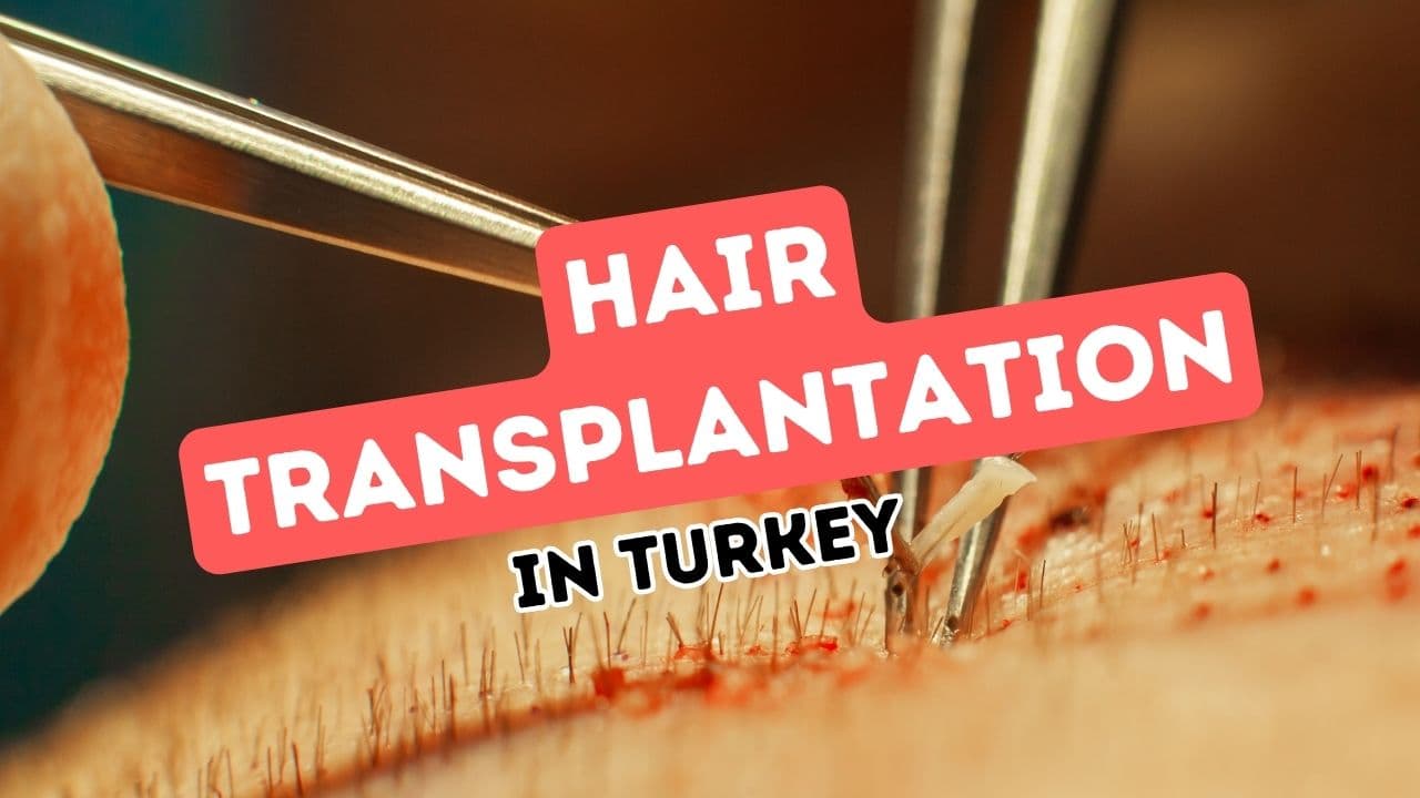 Türkiye'nin Uluslararası Ziyaretçiler Arasında Saç Ekimi İşlemlerine Popülaritesi Artıyor